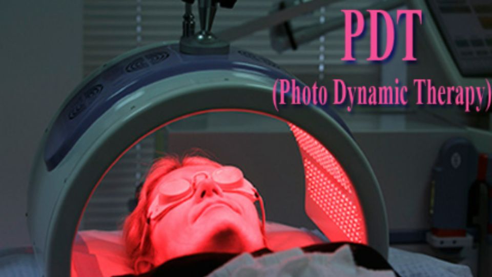 PDT (Photo Dynamic Therapy)